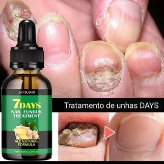 Óleo para Cuidados com as Unhas 10 ml